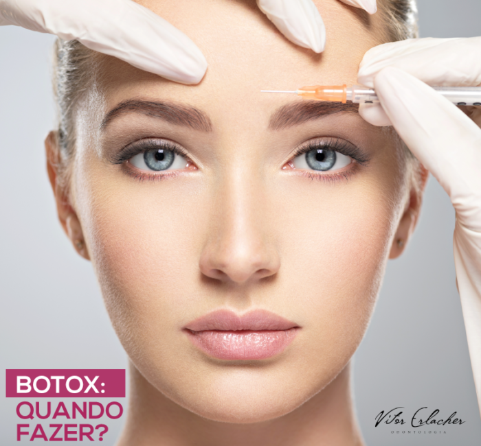 Botox: Quando Fazer?