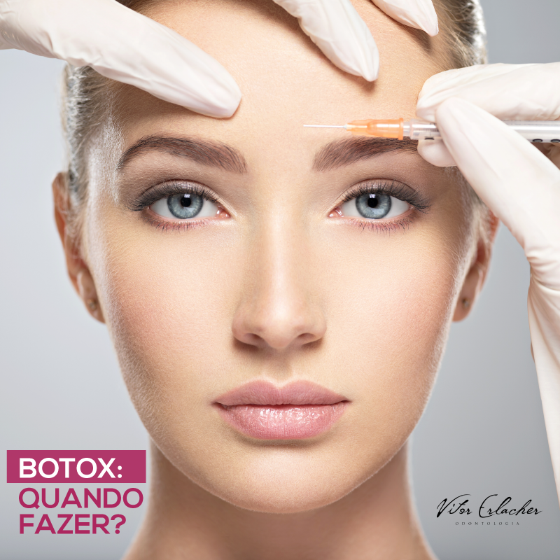 Você está visualizando atualmente Botox: Quando Fazer?