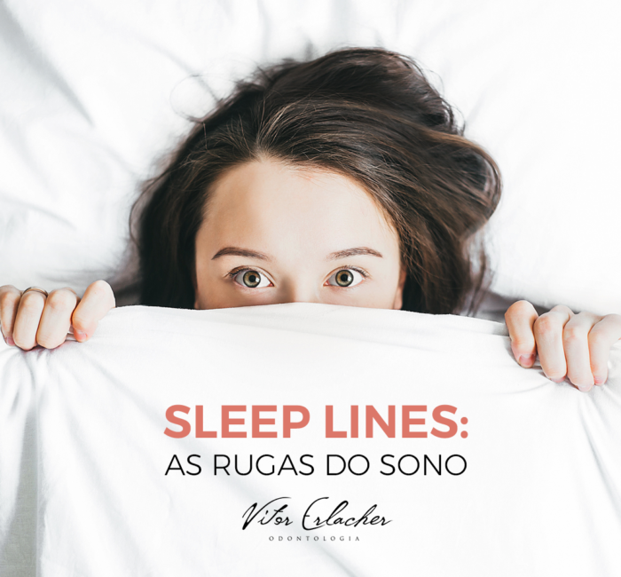 Sleep Lines: Como evitar rugas no rosto e colo