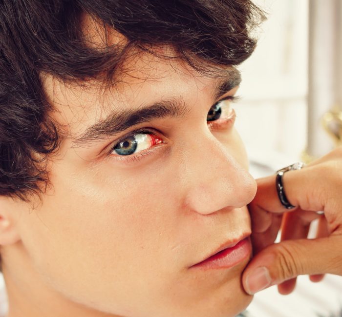Autoestima masculina: Homem também faz preenchimento labial
