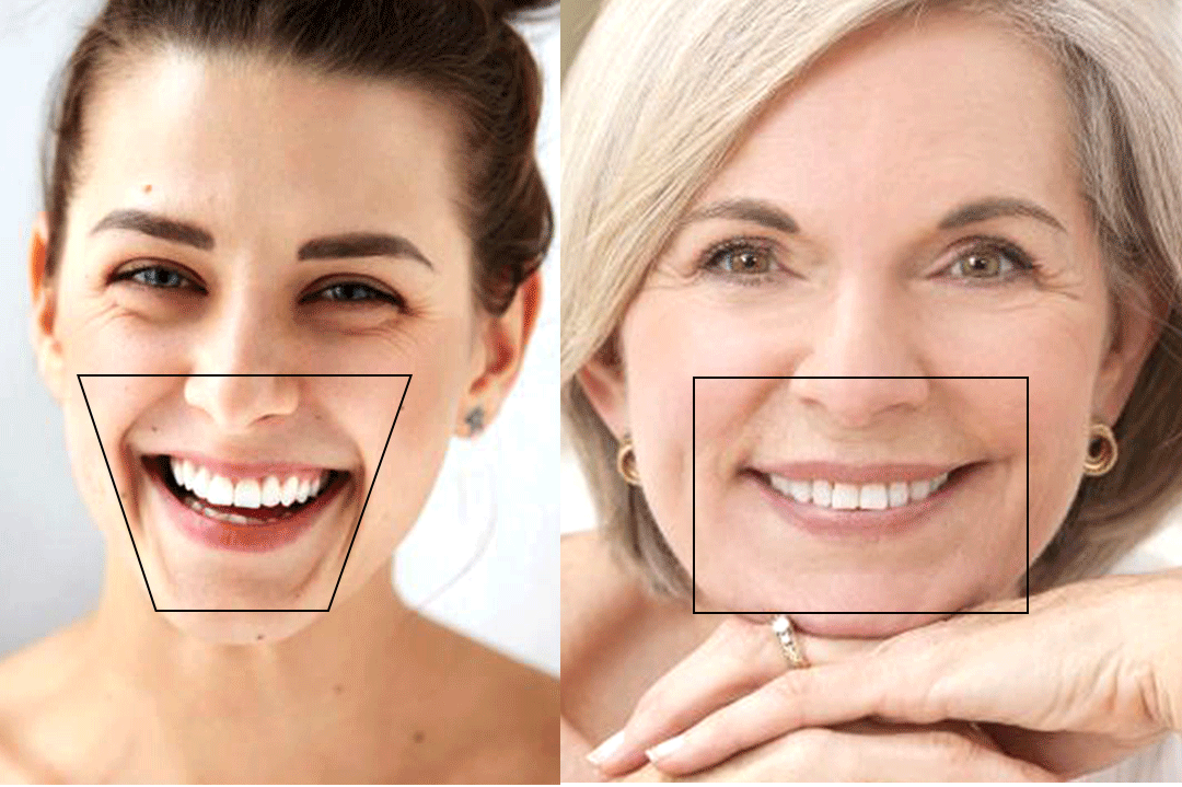 Você está visualizando atualmente Envelhecimento: Como o formato do rosto muda conforme a idade