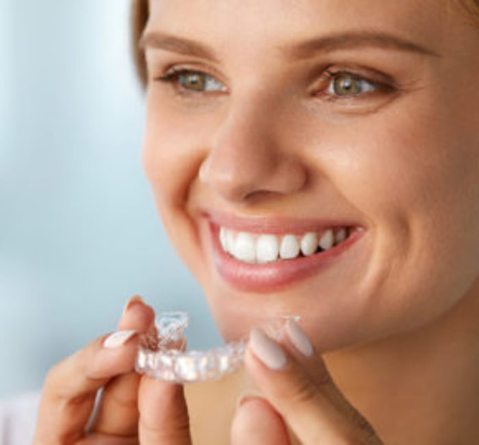 Invisalign: A revolução dos aparelhos ortodônticos