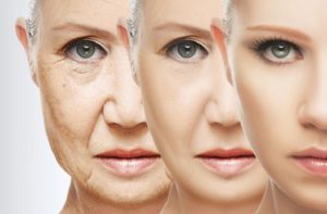 Leia mais sobre o artigo Envelhecimento facial: Como ocorre o aumento da flacidez no rosto?