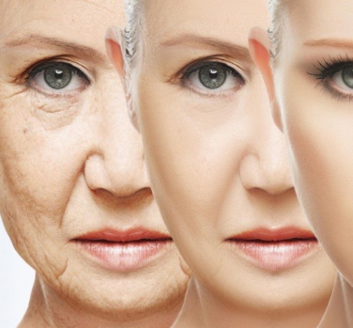 Envelhecimento facial: Como ocorre o aumento da flacidez no rosto?