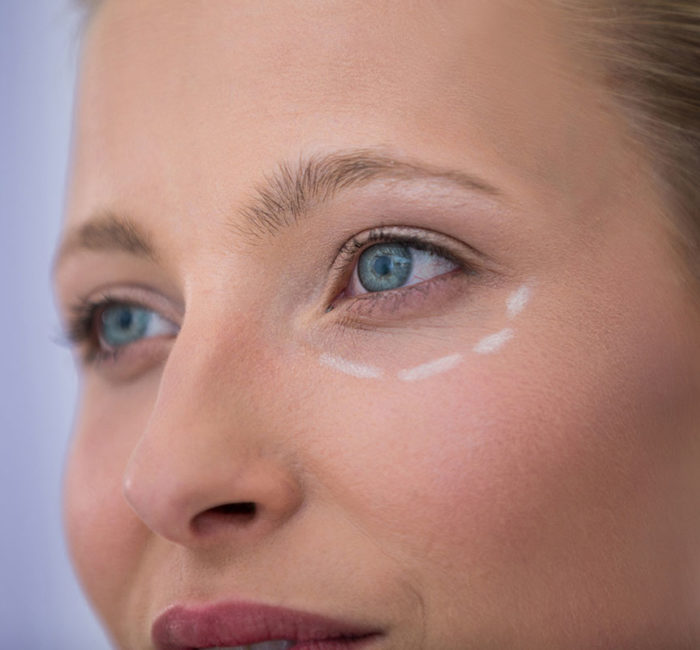 O que você precisa saber antes do primeiro preenchimento facial?