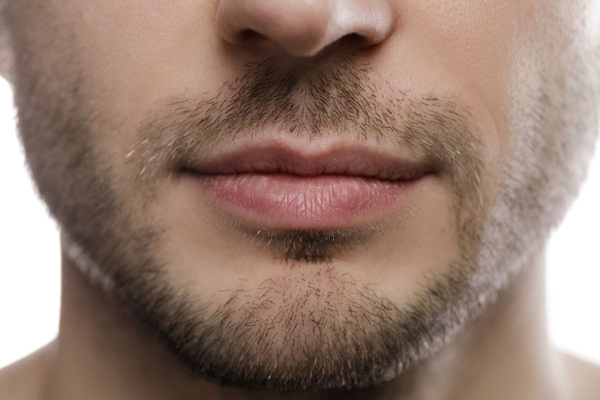 Preenchimento de mandíbula masculina: tenha um contorno facial mais definido  e forte * Dr Vitor Erlacher